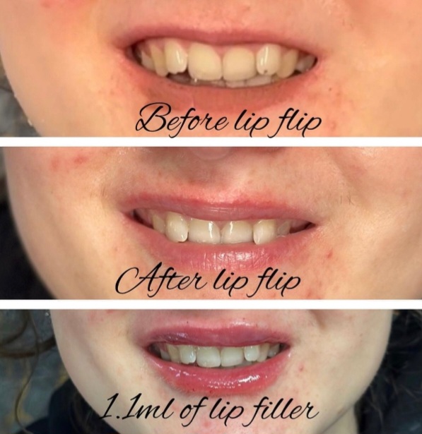 🤩 💉 Dunya Aesthetics in Bedford - Medic with an eye for artistry -   Valid from December 10, 2024 